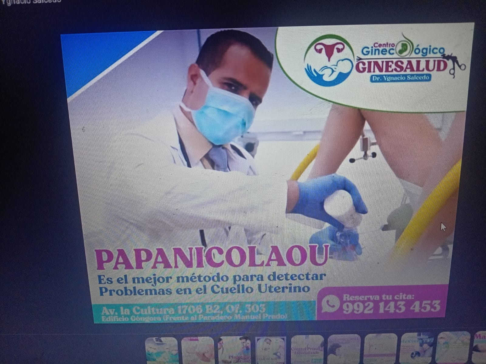 Papanicolaou
